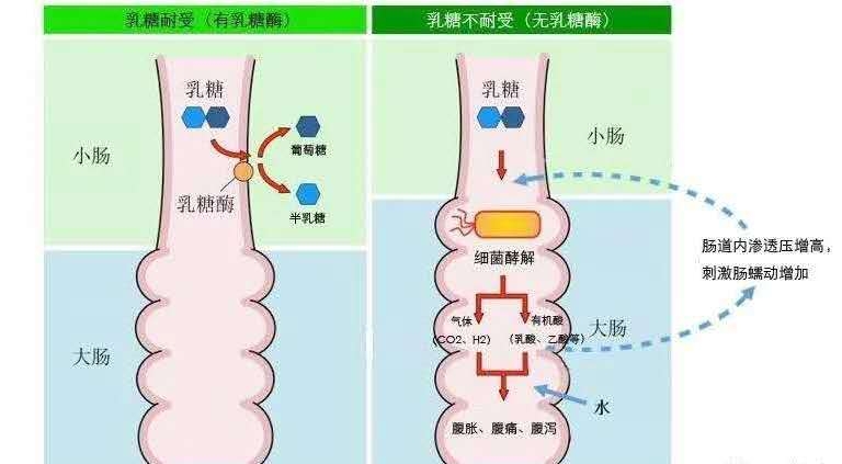 宝宝腹胀，拉泡沫状稀便，吃点乳糖酶可以吗？