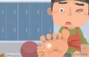 如何识别和判断是否患有鸡眼？