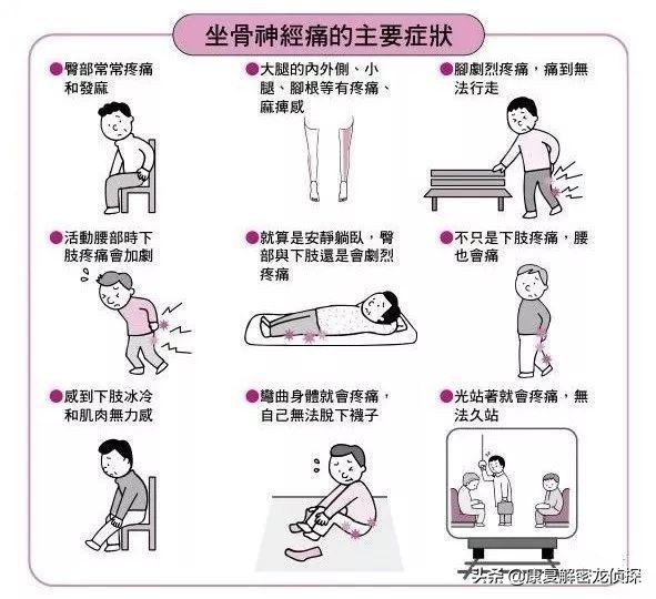 坐骨神经痛的锻炼方法(6个动作腰不疼了腿也不麻了)