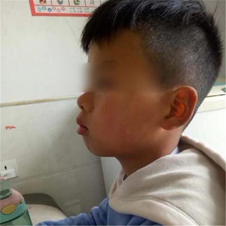 儿子脸型像“大猩猩”，妈妈调侃“长残了”，朋友提醒才知不对劲