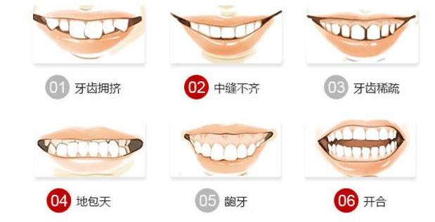 只有几颗牙齿长歪了，可以只做半口矫正吗？事情没你想的那么简单
