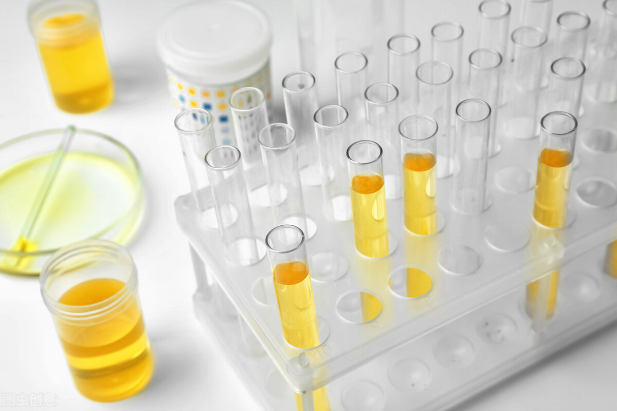 想要知道有没有尿毒症，要怎么做？这4种检查方法少不了