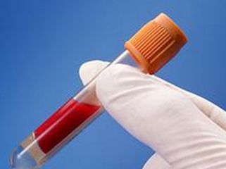 胰腺癌晚期能活多久？当胰腺癌遇上新型疗法，胰腺癌将被“征服”