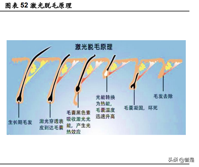 华东医药专题研究：全面覆盖“注射+仪器”医美项目