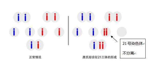 孕妈妈怀唐氏宝宝可以看出来吗？如何避免唐氏儿出生？