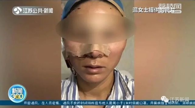 女子鼻头微微右偏，花3万整形后更难受了：鼻子整个朝左歪，鼻孔还不对称