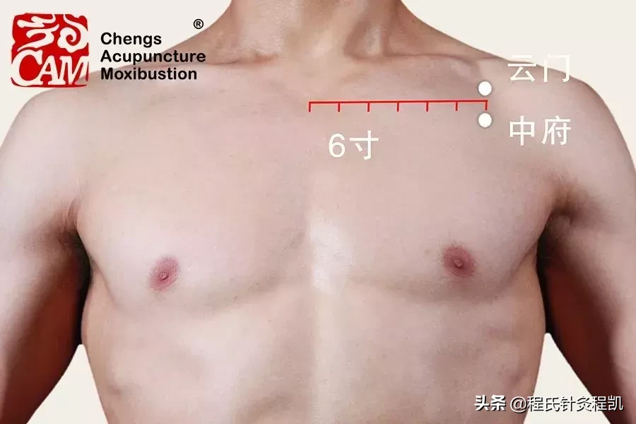 答疑解惑 | 脑出血后遗症，左肢麻痛，按摩哪几个穴位能缓解痛苦