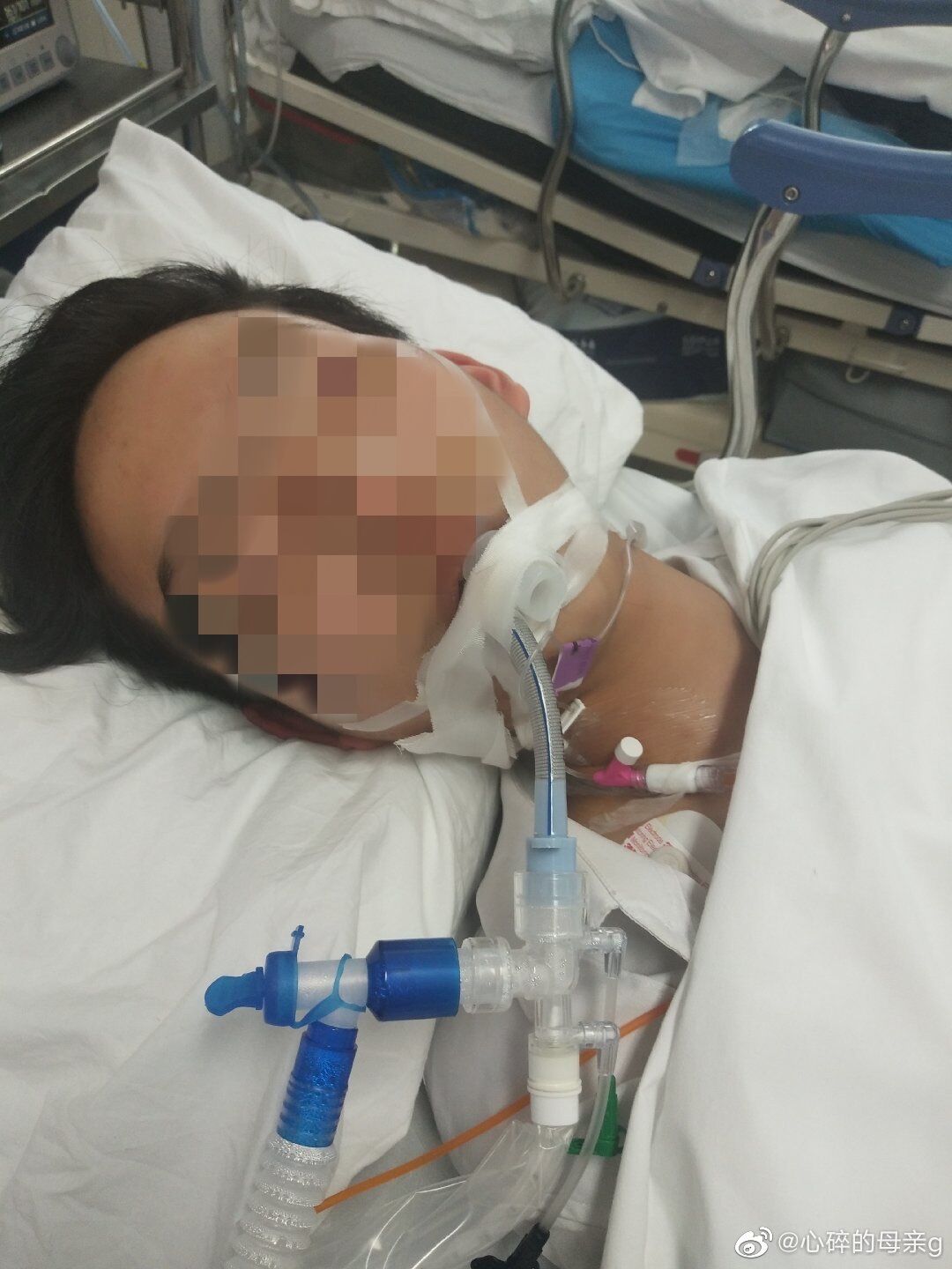 疑为阻止校园暴力，南通15岁少年遭同学殴打后死亡：校方自称无责，多名目击同学拒绝和死者家属见面