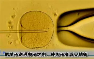 做试管婴儿全过程，看完真的心疼女性一万遍！