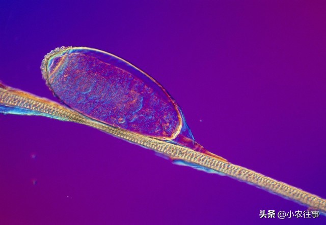 虱子是怎么產生的,