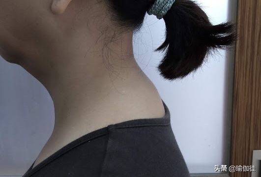 耳朵后面骨头凸起图片(脖子后面凸一包是) - 赤虎壹号
