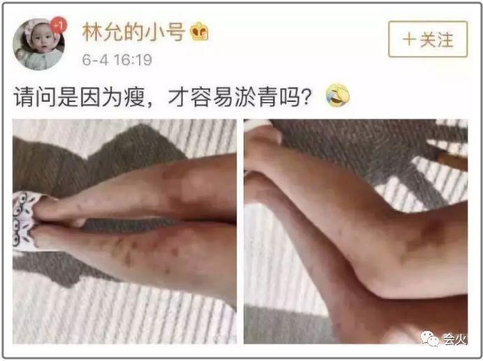 蔡徐坤周洁琼传恋情，林允或成最大赢家？