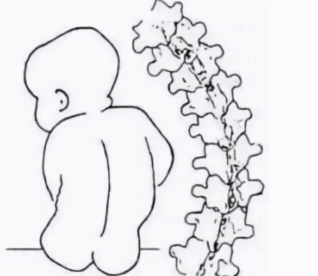 孩子的2种"错误坐姿",容易造成"罗圈腿",家长需要引起重视