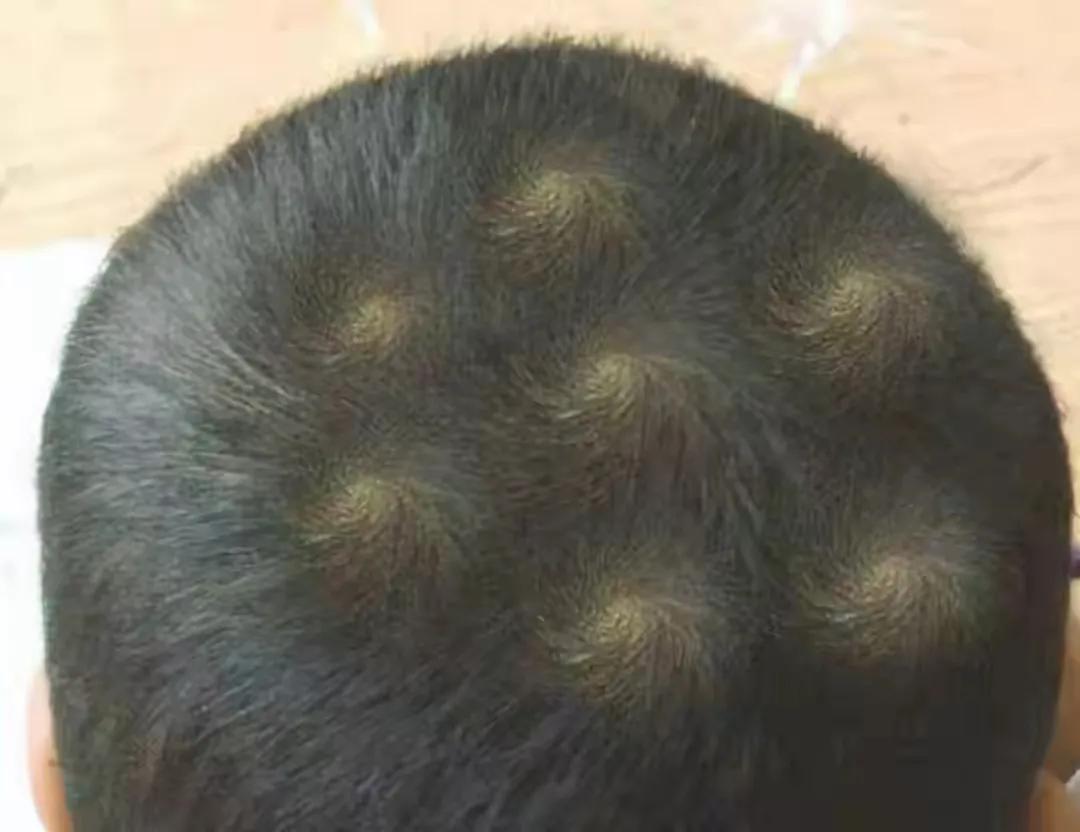 发旋与智商,性格有关系吗?父母需要做好3点