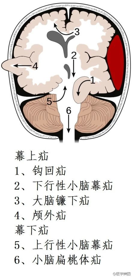 神经元结构示意图（神经元结构示意图手绘）-第37张图片-科灵网