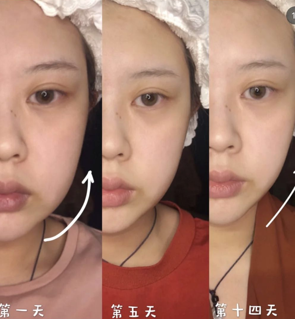 自己在家就能做的“面部提拉法”,紧致嫩肤,提拉瘦脸,简单易学