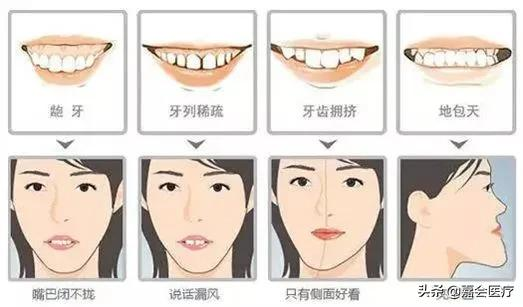 已经成年，还能做牙齿矫正吗？口腔科医生告诉你答案