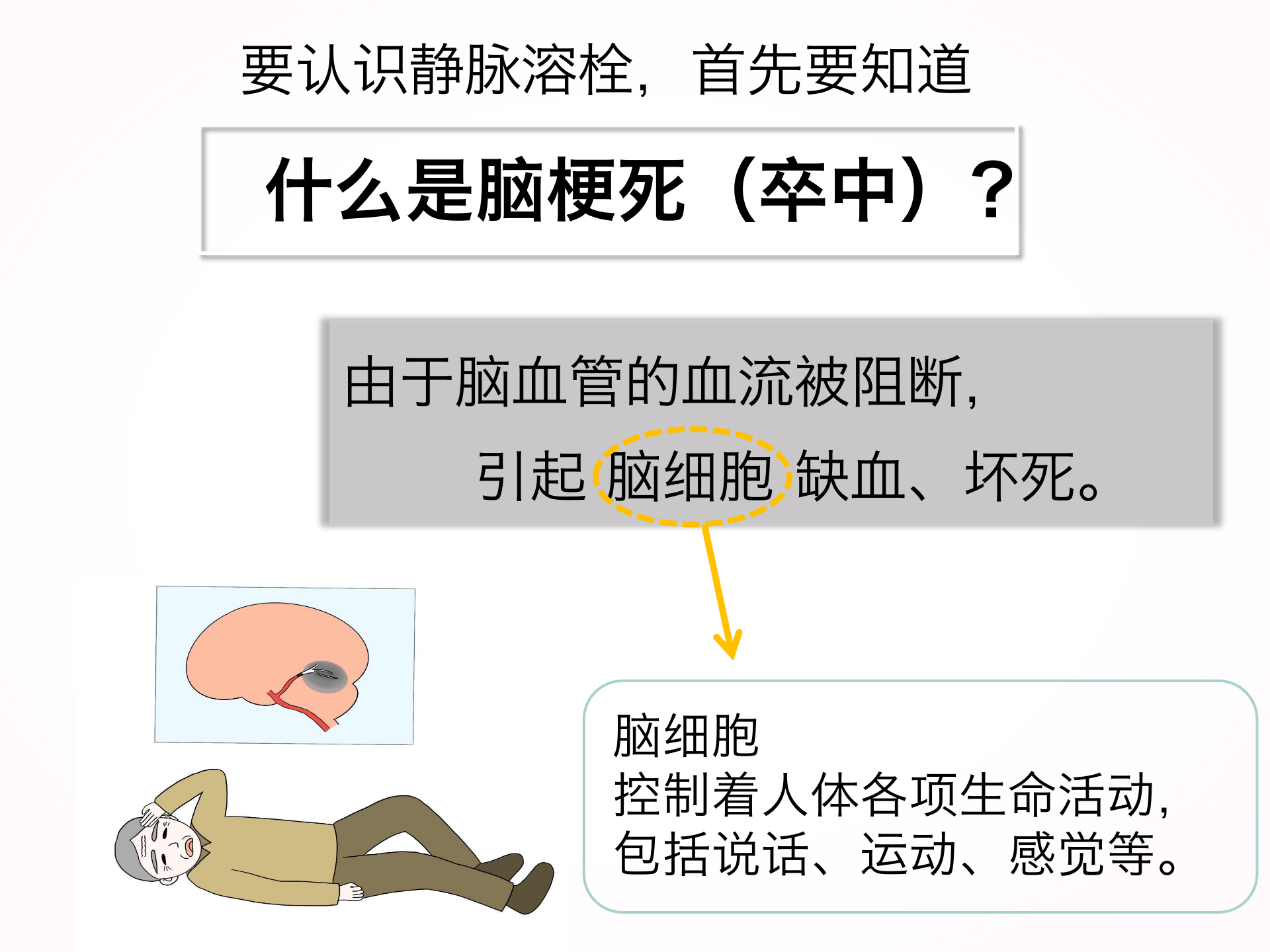 您为什么要选择静脉溶栓？