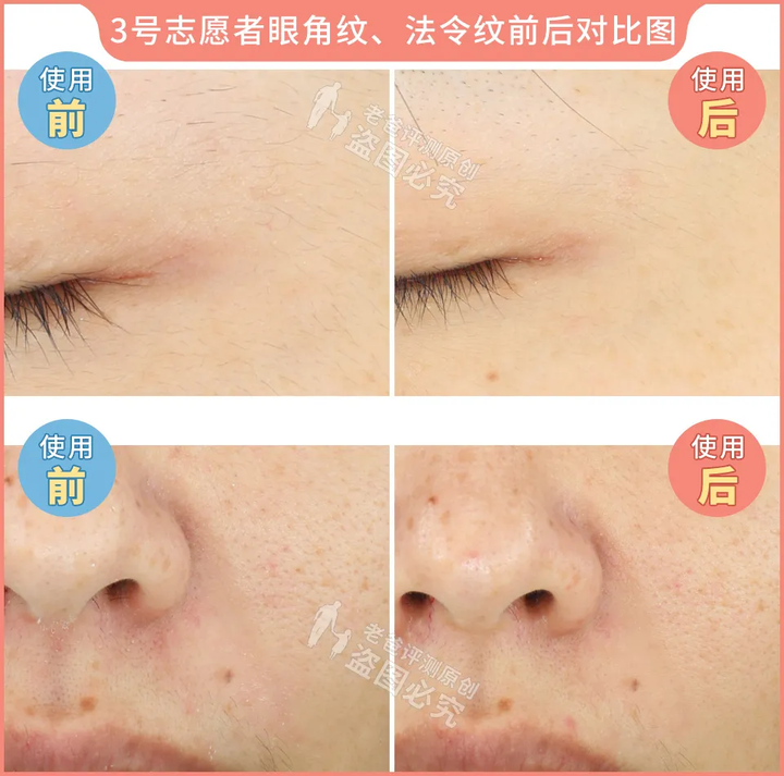 网红家用美容仪真的有效吗？2个多月的跟踪实测结果来了