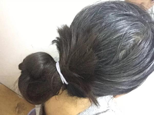 如果女性白头发增多，不要总认为老了，或是因为体内缺乏3种营养