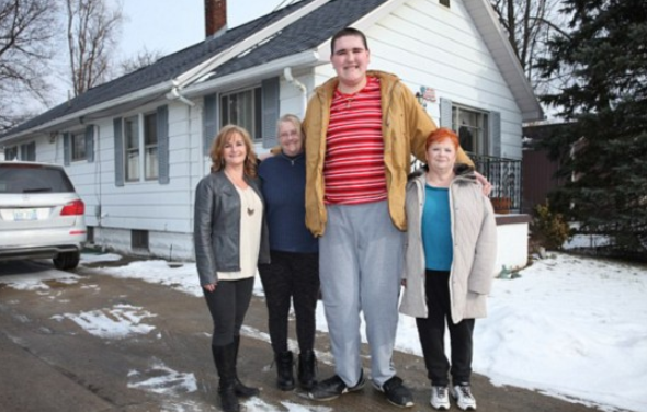 为什么nba不要巨人症(他患有巨人症,21岁身高2米34,强壮的体格能媲美