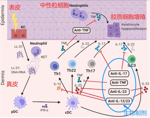 银屑病（下篇）：生物制剂和营养素