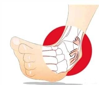 打完篮球吃什么比较补充体力（运动损伤后的康复训练（篮球篇））