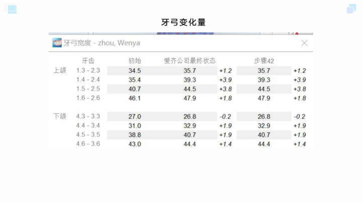 广州牙齿矫正杨露隐适美隐形矫正戴牙套全案例