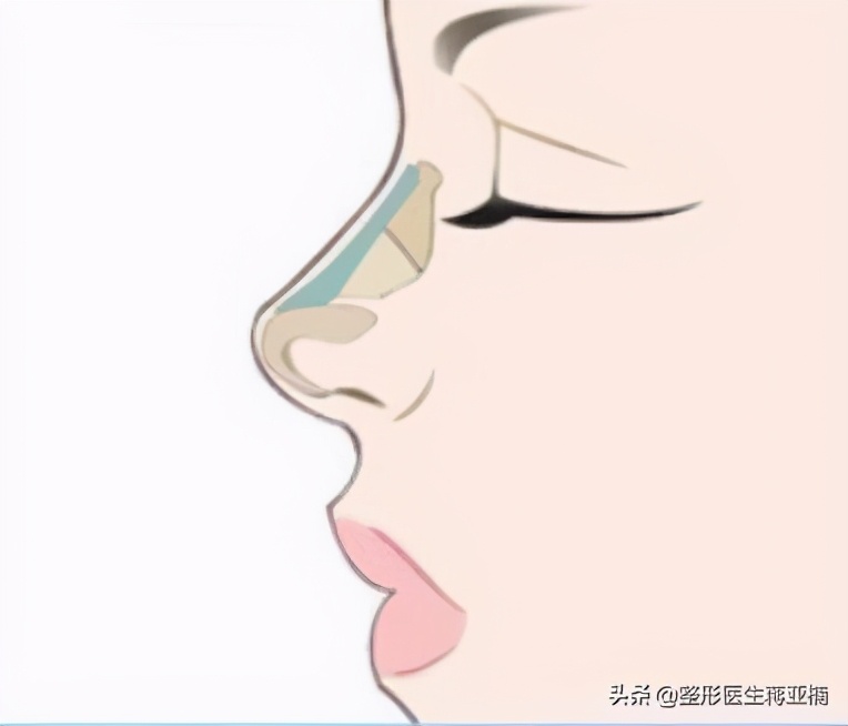 九种鼻型解析｜哪种鼻子是你理想鼻型？