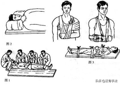 正骨手法的练习需要长期努力，历代名家是这样练习手法的