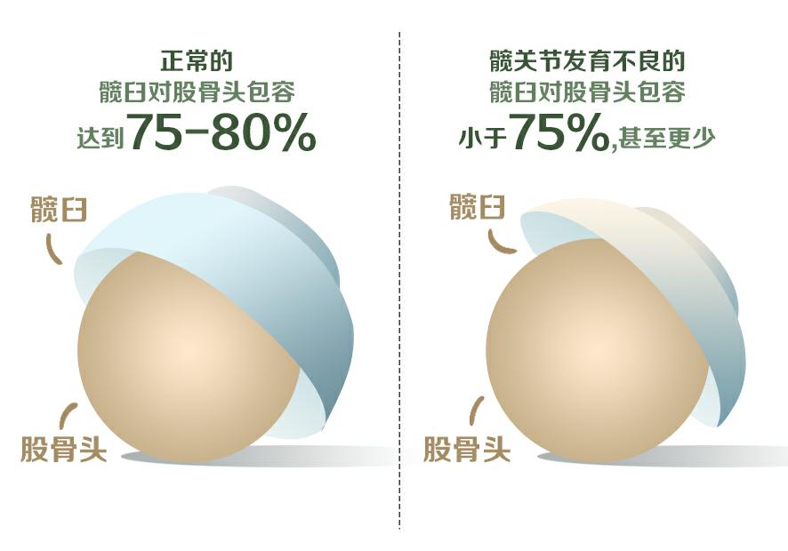 走路走久了胯耻骨就疼，究竟怎么回事？