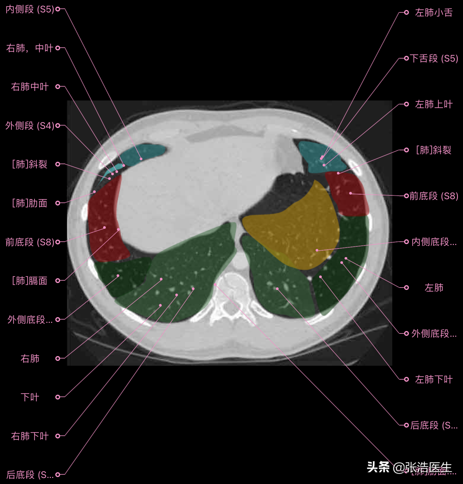 肺ct分叶分段解剖图图片