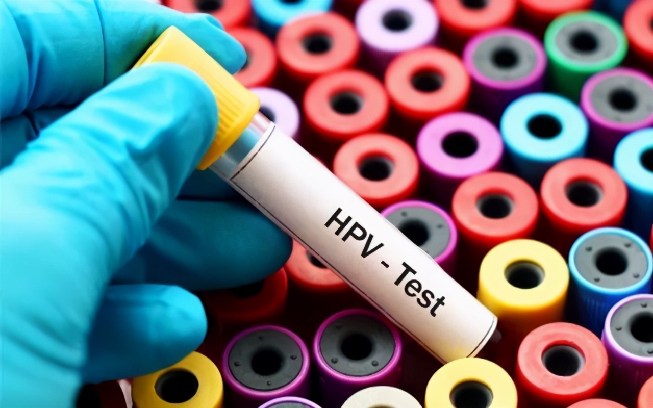 Hpv病毒到底是什么，会传染吗？