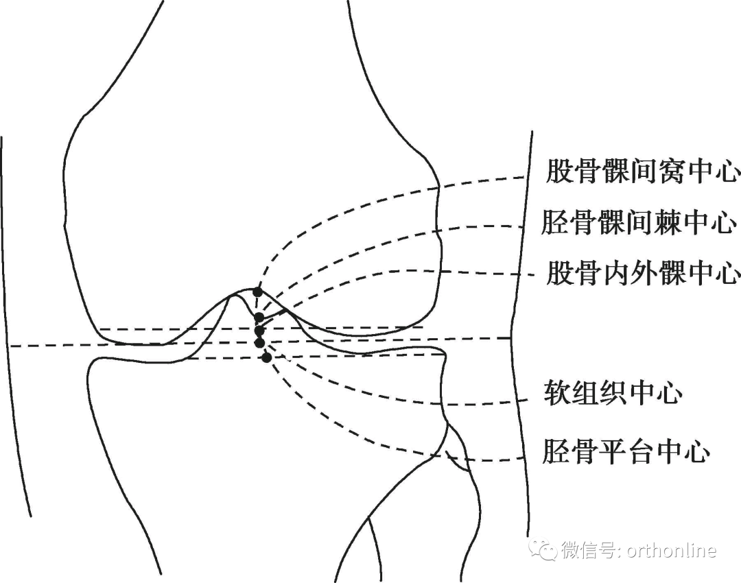 如何根据X线测量下肢力线