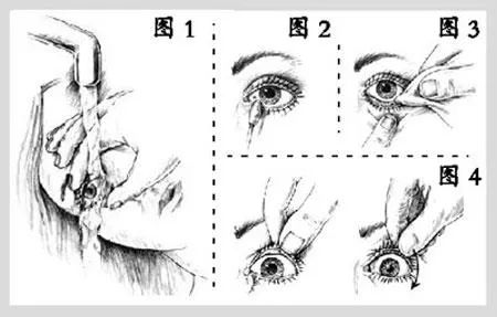 孩子眼睛进入异物，这２个情况要及时就医