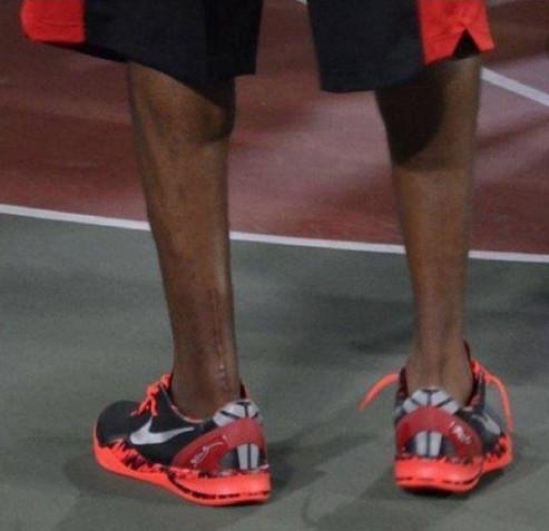 为什么nba黑人小腿特别细(黑人球员体型特点，大多是粗胳膊细腿，这种体型是为篮球而生的)