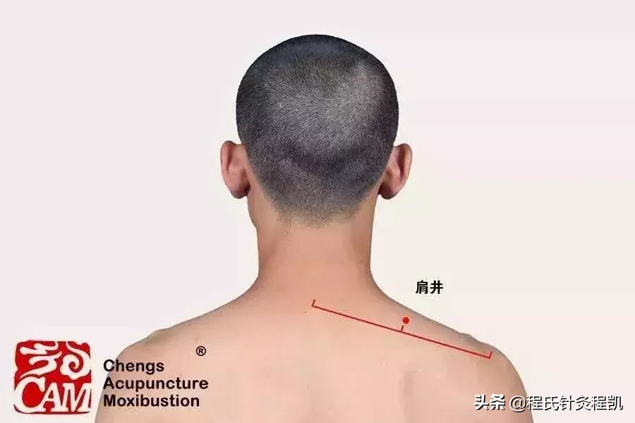 答疑解惑 | 脑出血后遗症,左肢麻痛,按摩哪几个穴位能缓解痛苦