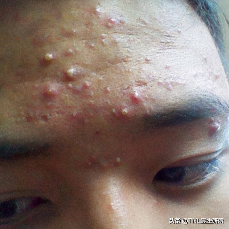 如何区分皂基洗面奶和氨基酸洗面奶？哪种更好用？