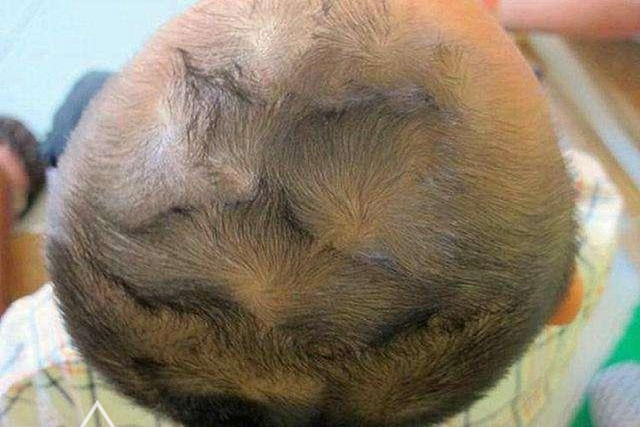 额头有旋面相怎么样 额头有旋涡的面相解析_达一风水网