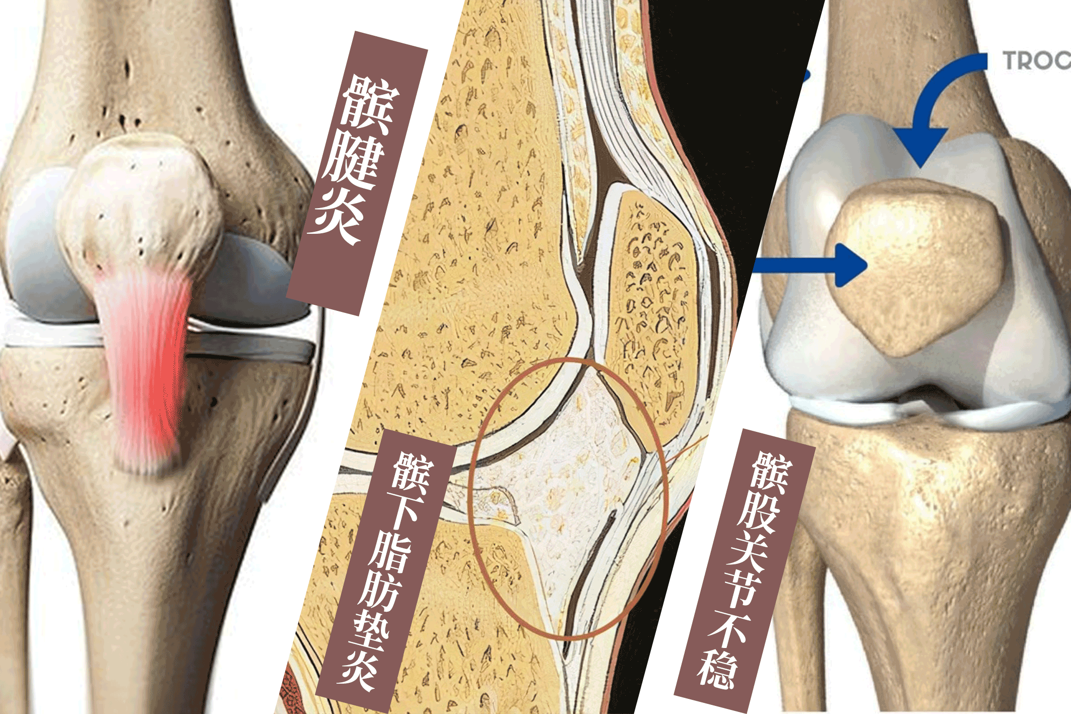 老人膝盖疼是怎么回事(小心6种疾病个个危害巨大)