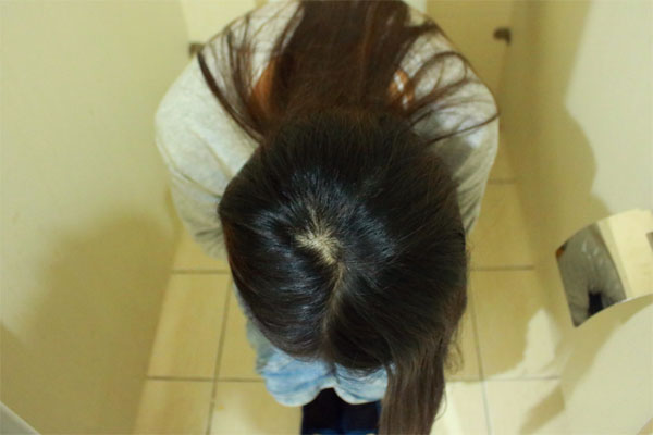 长期大便不成形 长期大便不成形的危害-春风号