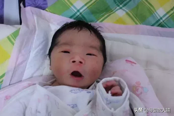 新生儿脱皮红斑现象的原因及处理方法