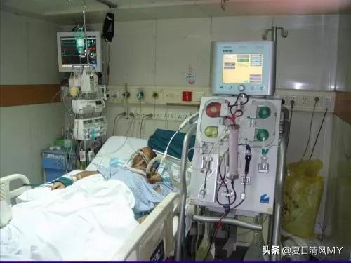 亲身经历ICU，想想都恐怖