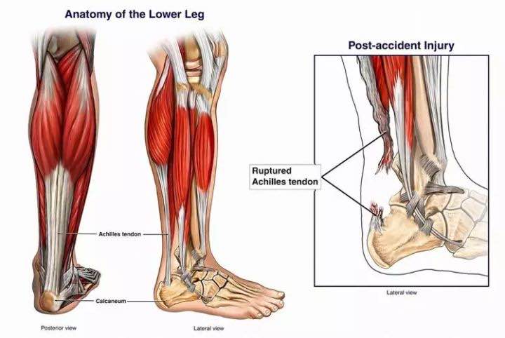 打完篮球吃什么比较补充体力（运动损伤后的康复训练（篮球篇））
