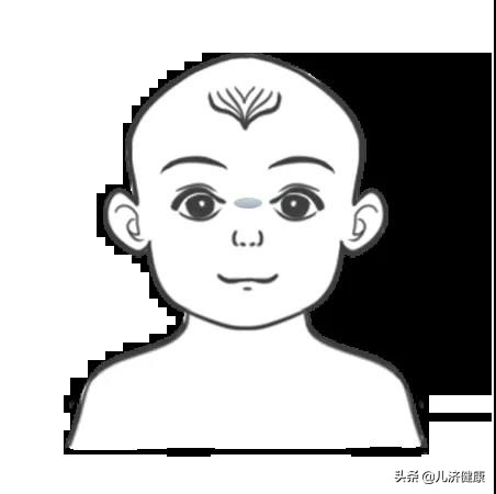 许尤佳教授：儿童脾胃虚寒调理指南与案例