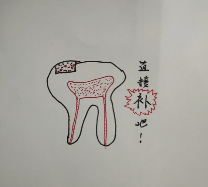 口腔医生耐心画图为你解答｜牙齿龋病的正规治疗方式