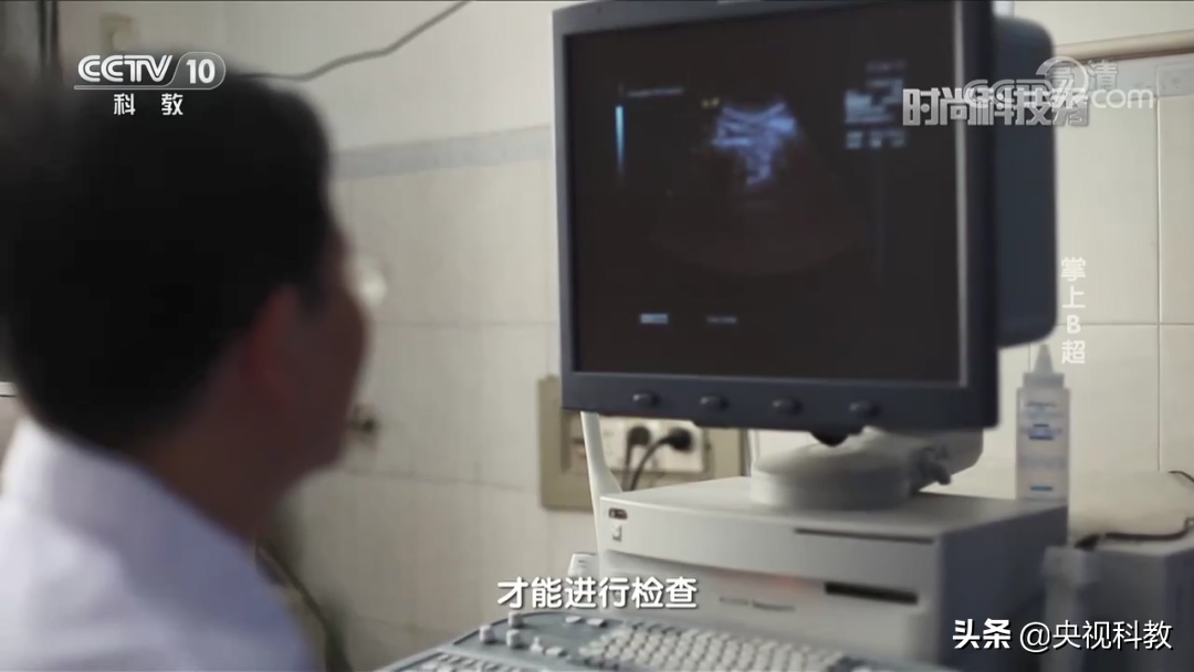 在家就能做B超？帮你节省医院排队的时间！