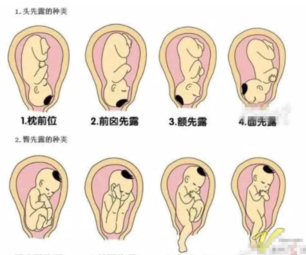 宝宝头型不正其原因可查，往往是这些原因造成的，及时修正来得及