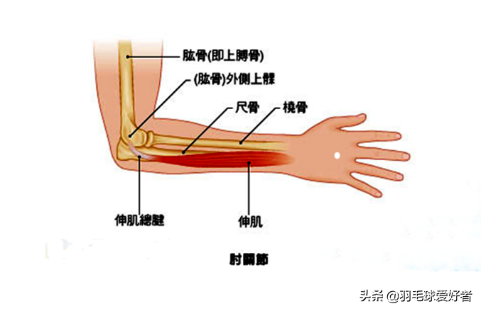 羽毛球如何防止受伤(打羽毛球总受伤？别担心，全面分析让你告别伤痛，快乐打球)