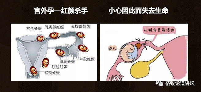 子宫在身体的什么位置图如何保护子宫